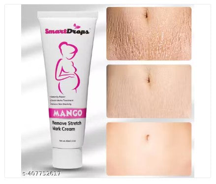 Stretch Mark Removal Cream for Women and Men – Scar Repair, Skin Firming & Nourishing Cream